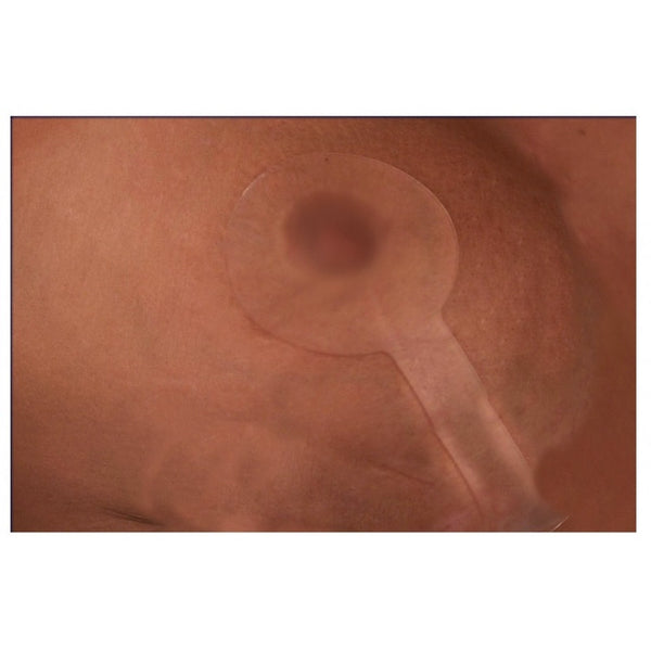 Scar Fx Lollipop Mastopexy Breast Silicone Sheet